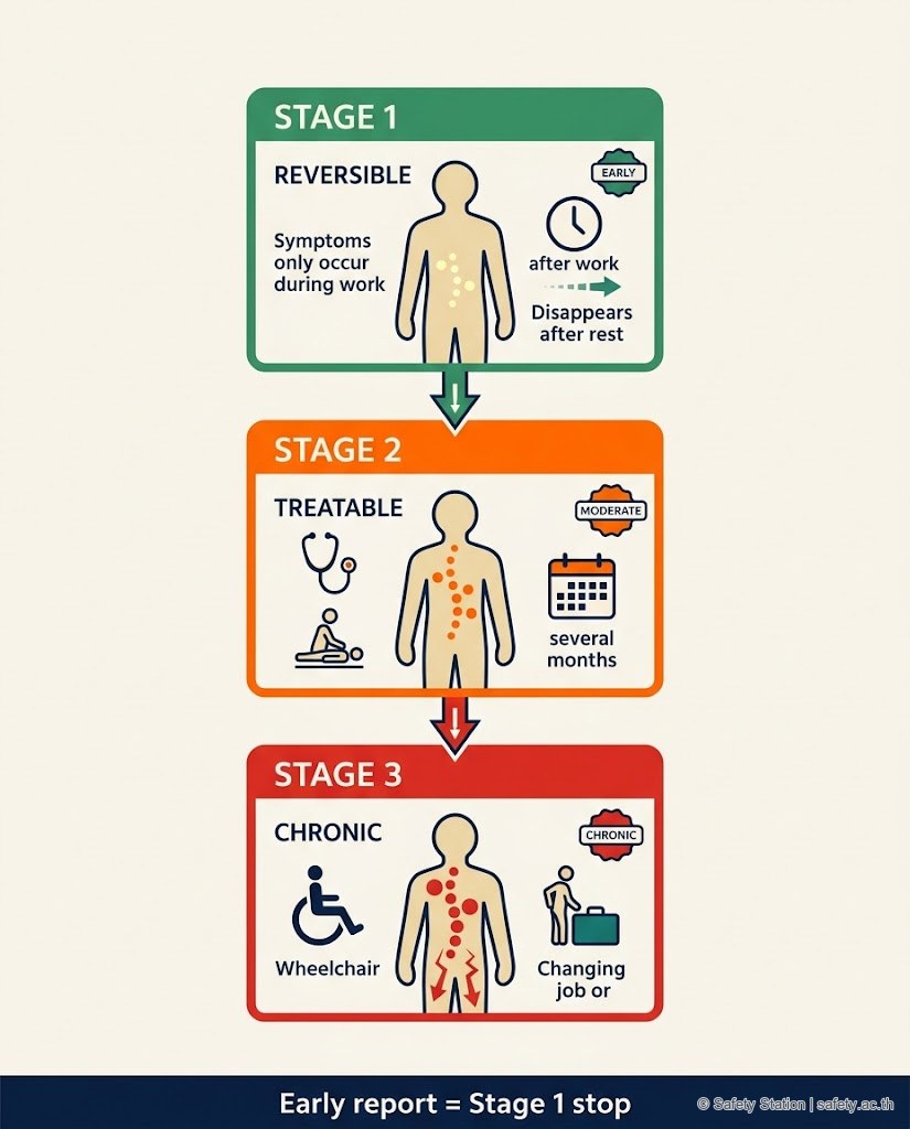อินโฟกราฟิก Stage 1/2/3 ของ WMSDs — Stage 1 reversible (อาการเฉพาะตอนทำงาน) → Stage 2 moderate (ปวดต่อเนื่อง) → Stage 3 chronic (เรื้อรัง อาจต้องเปลี่ยนงาน)